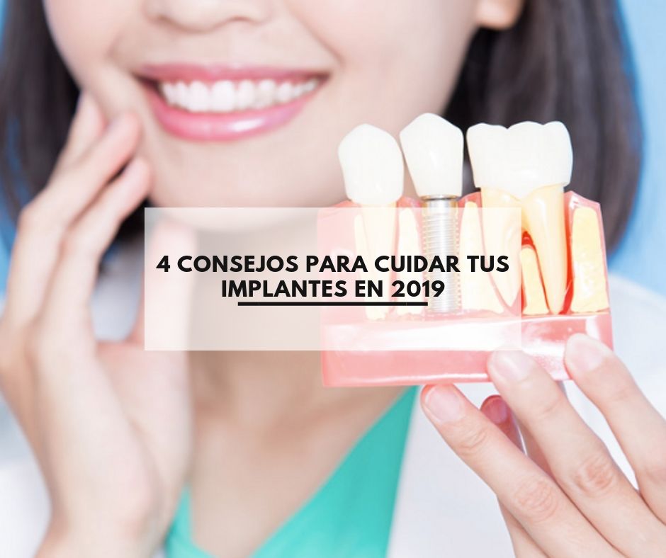 Implantes dentales