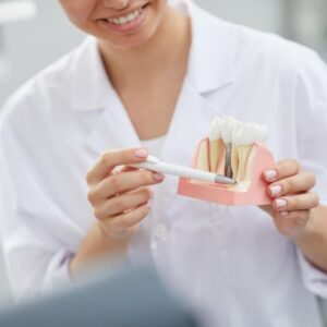 Implantes dentales vs puentes dentales. ¿Cual es mejor?